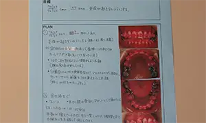予防プログラム再立案