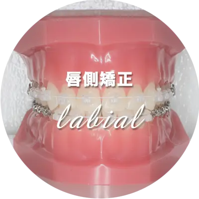 表側矯正