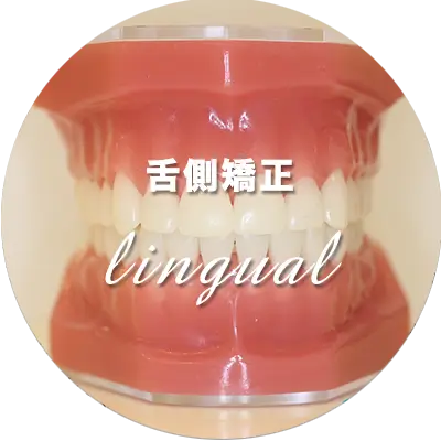 舌側矯正